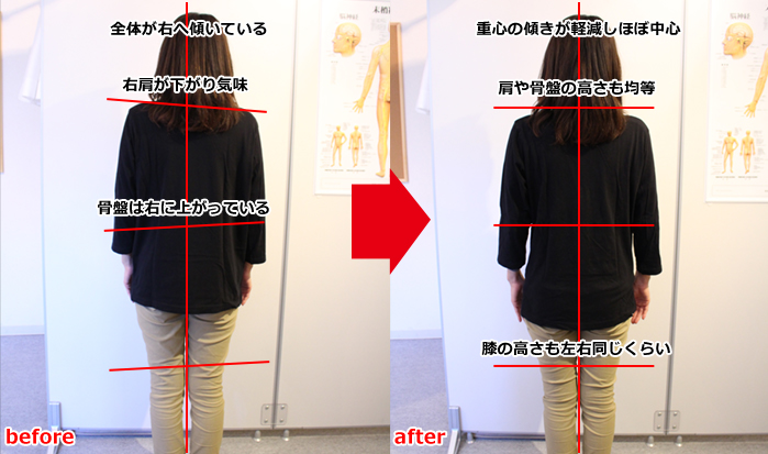 神奈川カイロプラクティック整体院による慢性腰痛の対策